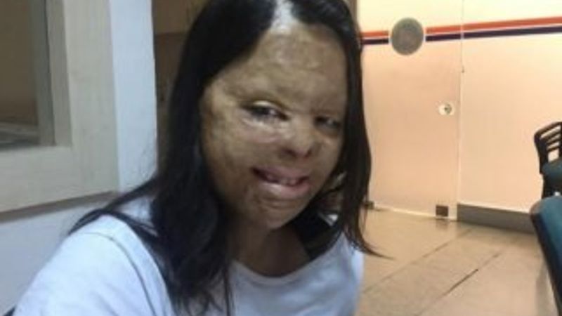 Antalya'da 81. kez yüzü için ameliyat oldu