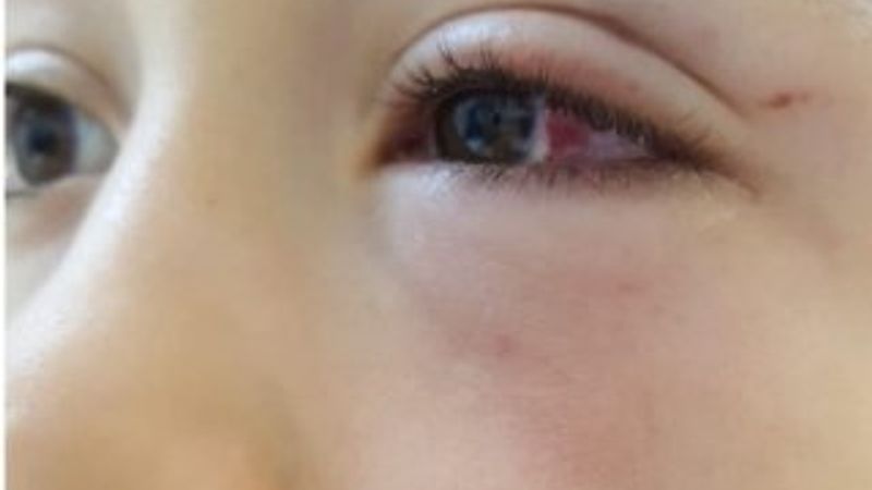 Oğluyla tartışan 9 yaşındaki çocuğu yumrukla dövdü