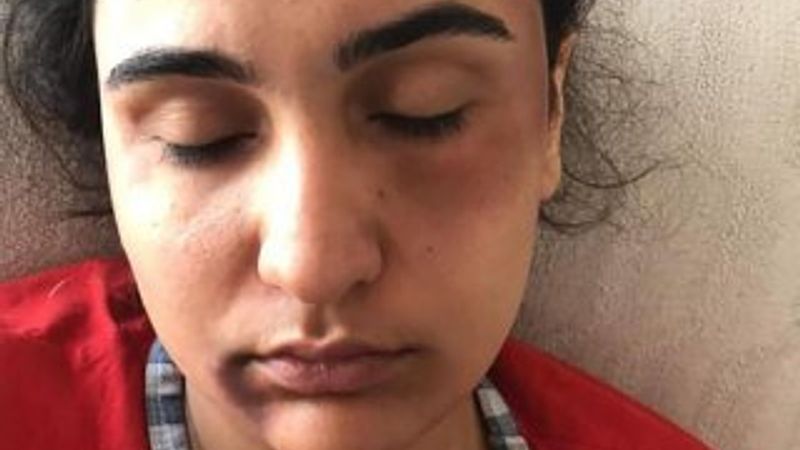 Kocaeli'de kayınpeder dehşeti