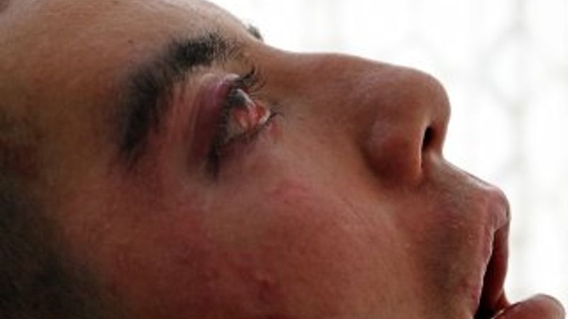 28 yaşında hastalığından yatağa mahkum oldu