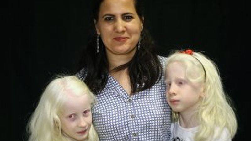 Adanalı albinolar, 4 mevsim gölge arıyor