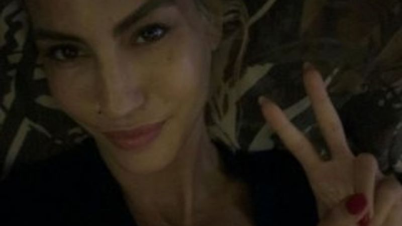 Çağla Şıkel son durumunu paylaştı