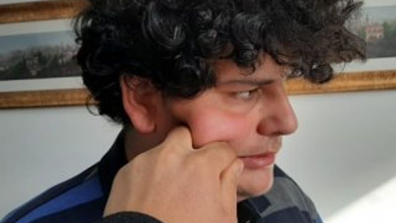 Yanaktan makas almak tazminat sebebi sayıldı