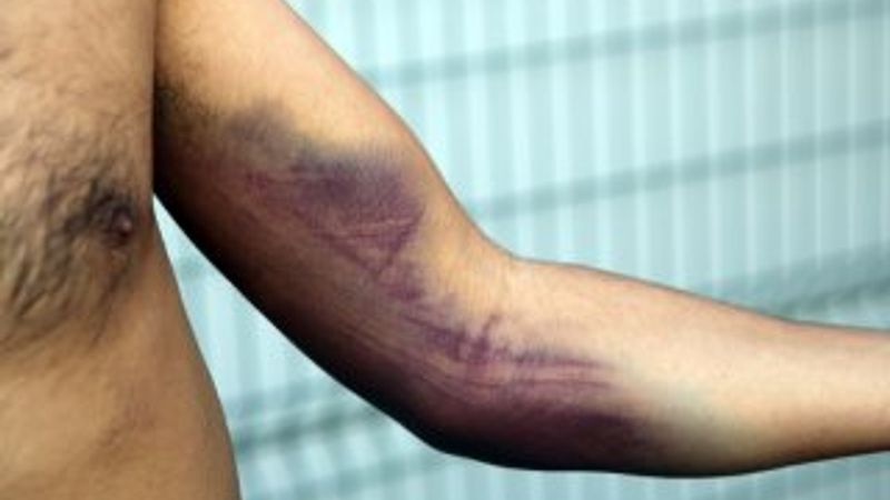 Yunan askeri göçmenleri silahla dövdü