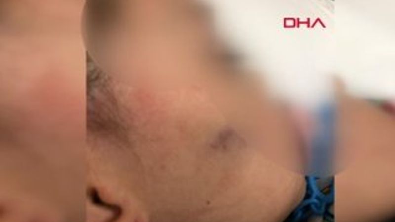 Anaokulunda işkence iddiası