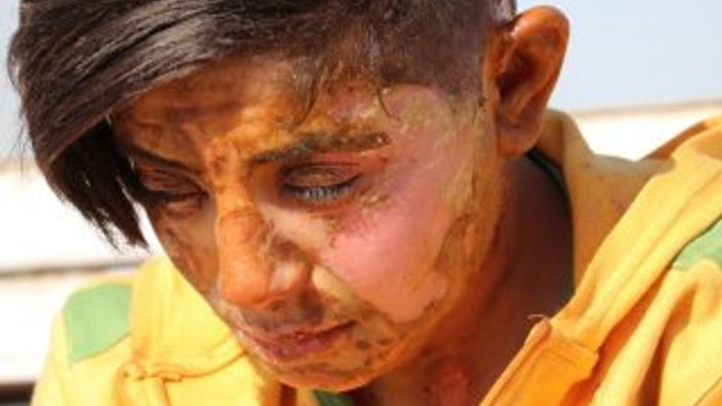 Telefonunu çaldığı genç kızı yakan cani yakalandı