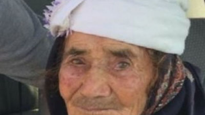 Sokak köpeğinin yüzünü parçaladığı kadın yaşam savaşında