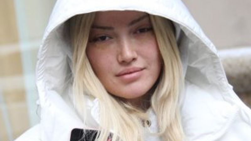 Danla Bilic gözlerinden estetik oldu