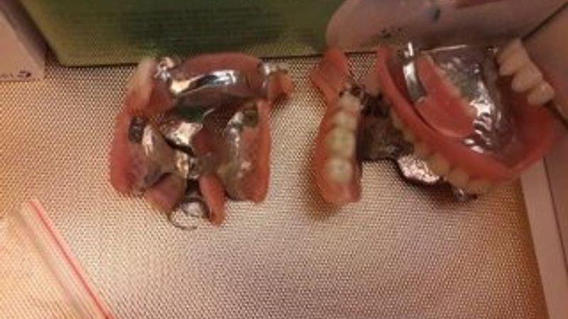 Sahte dişçi yakalandı, muayenehanesi mühürlendi