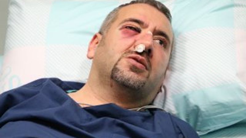 Kahramanmaraş’ta bir sağlık teknikeri saldırıya uğradı