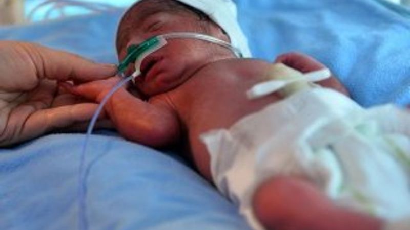 Mersin'de yaşayan Suriyeli çiftin dördüz çocukları oldu