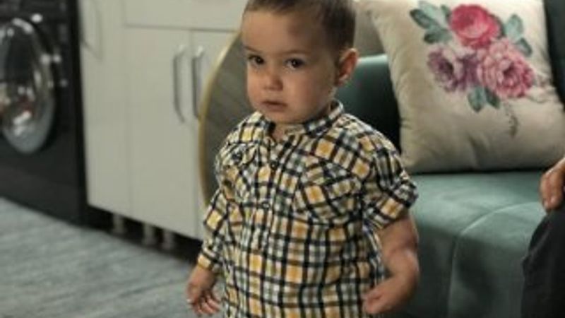 Minik çocuğun kolundaki yaranın sebebi bilinmiyor