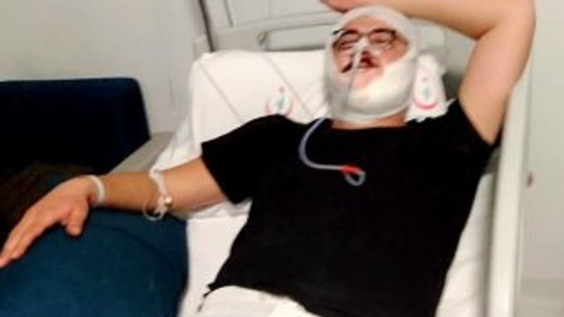 Boks antrenörü kavga ettiği şahsın çenesini kırdı