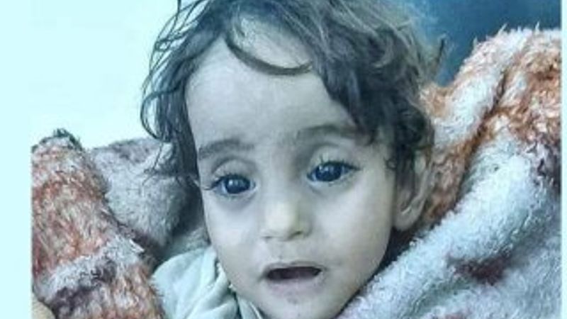 İman bebek, soğuktan ve yetersiz beslenmeden öldü