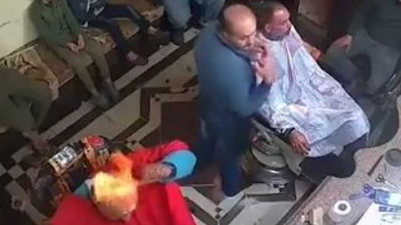 Bakım yapan adam, kafasını yaktı