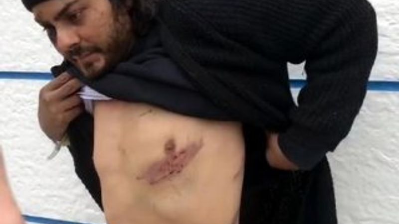 Yunan askerleri, Mısırlı göçmeni demir çubukla dövdü