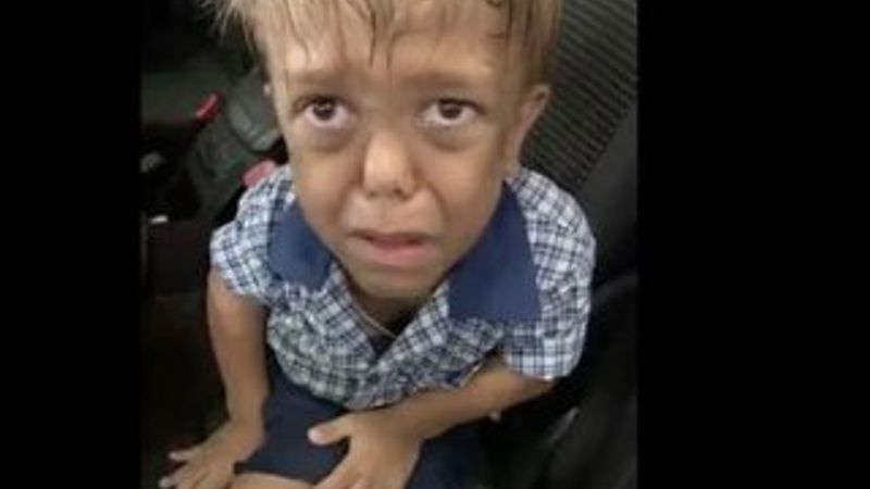 Cüce diye aşağılanan 9 yaşındaki çocuğa ünlülerden destek