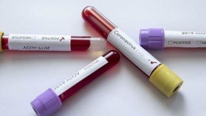 BAE'de 2 kişide daha koronavirüs tespit edildi