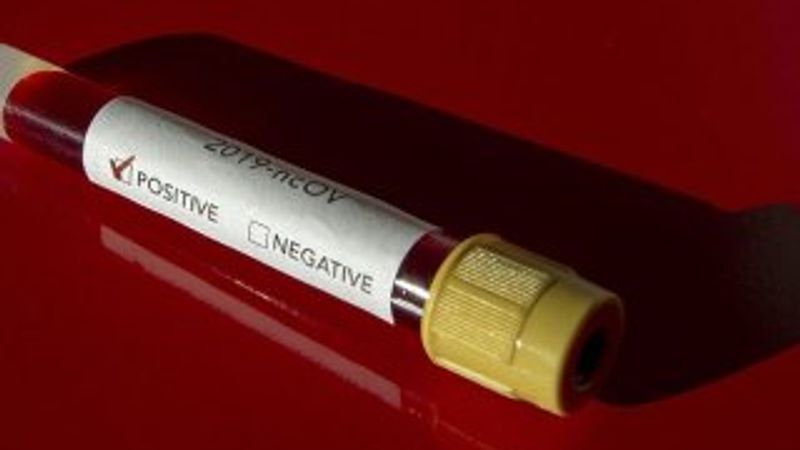 Koronavirüs Yeni Zelanda ve Nijerya'ya da sıçradı