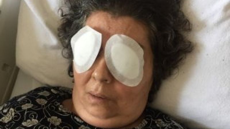 Şizofren kadın, bir hastanın gözlerini çıkardı