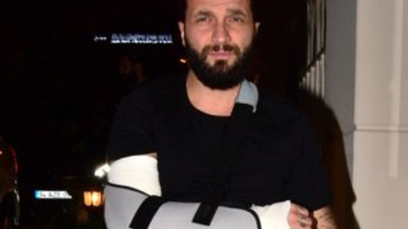 Berkay kolunu kırdı