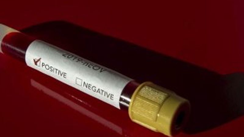 Kırgızistan'da ilk koronavirüs vakası tespit edildi