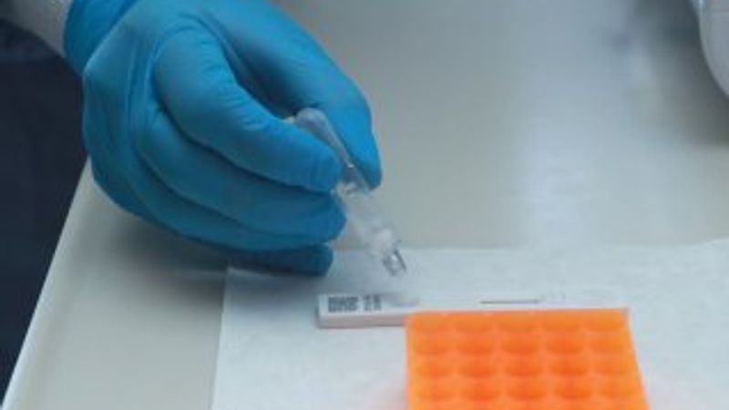 15 dakikada sonuç veren tanı kitinin kullanımına başlandı