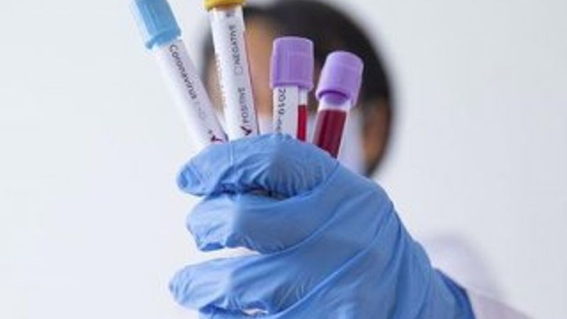 ABD'de korona testine fahiş ücret