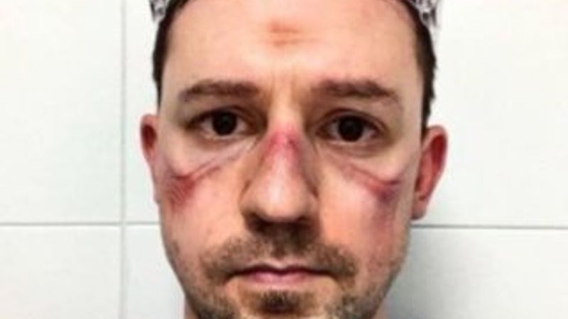 İtalyan doktorların koronayla mücadelesi