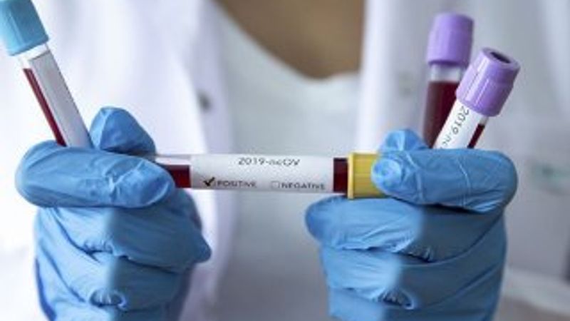 Koronavirüs olası vaka tanımına yeni madde eklendi