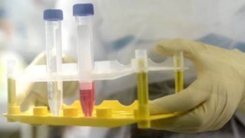 Oxford Üniversitesi, aşı çalışmalarını hızlandırdı