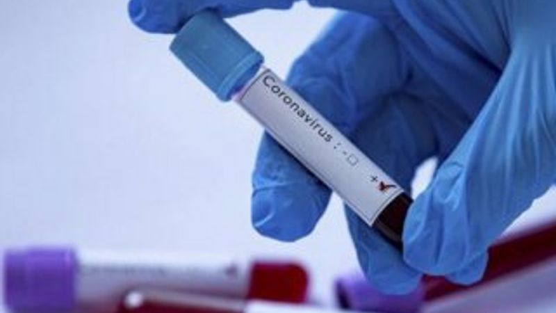 3 PKK'lı teröristten birinde koronavirüs tespit edildi