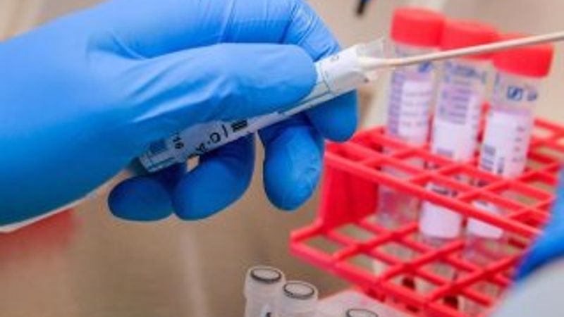 İngiltere’ye gönderilen test kitlerinde korona bulundu