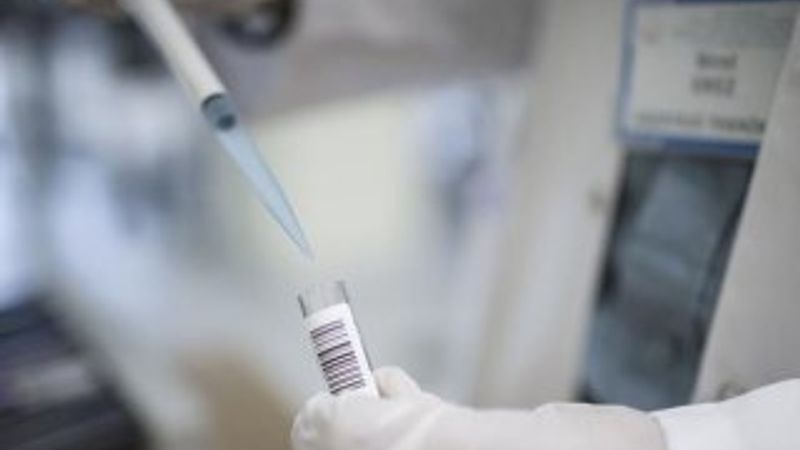 Korona tedavisindeki immün plazma kriterleri belirlendi