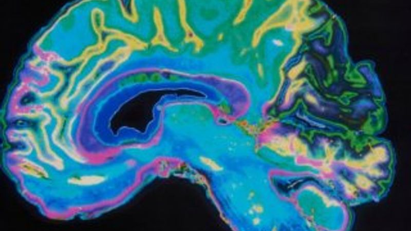 Düşünceleri metne dönüştüren yapay zeka geliştirildi