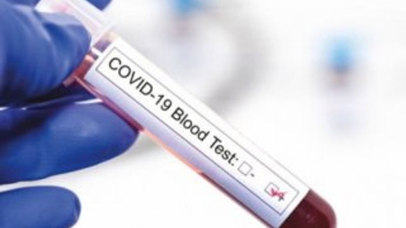 Koronavirüs tahlil bilgilerini gizliyen iki laboratuvara soruşturma