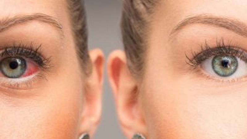 Şimdi lens kullanmak zamanı değil