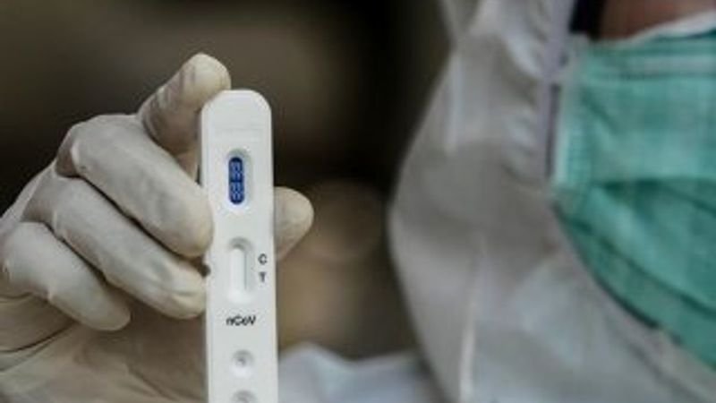 Dünya genelinde 1 milyon 433 bini aşkın korona vakası var