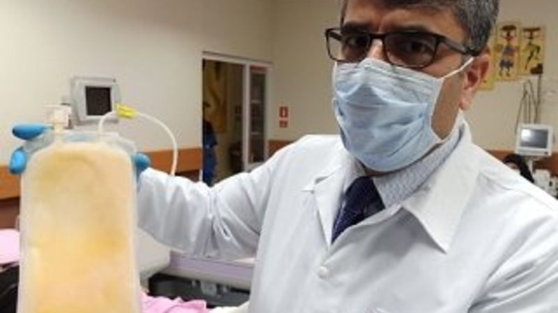 İmmün plazma tedavisi uygulanan hastada iyileşme var