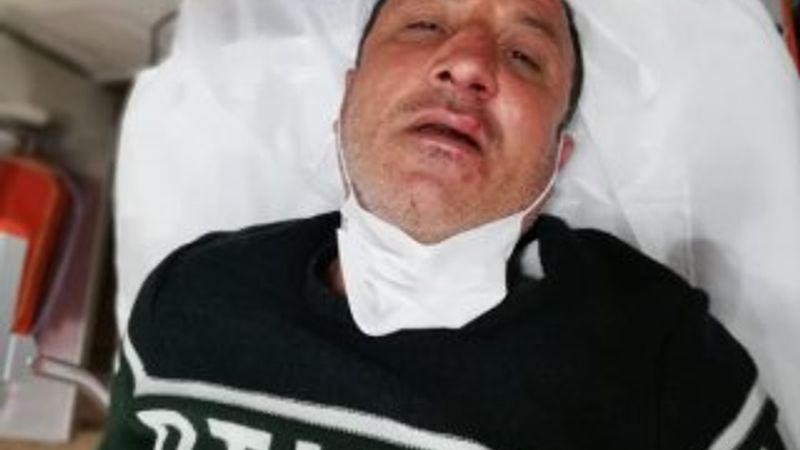 Küçükçekmece'de polise saldıranların son hali