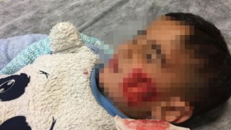 Şanlıurfa'da sokak köpekleri 6 çocuğa saldırdı