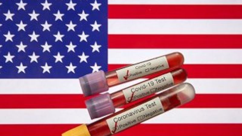 ABD'de koronavirüs ölümleri 31 bine yaklaştı