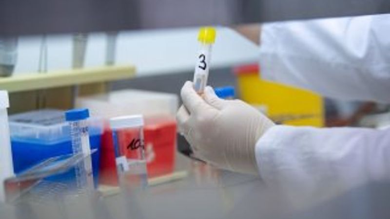 Çukurova Üniversitesi, koronaya alternatif tedavi geliştirdi