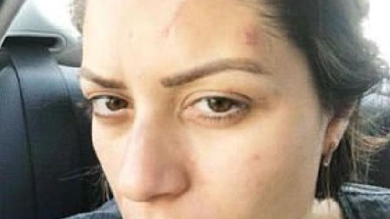 İzmit’te kadın avukat, eski eşinden şiddet gördü