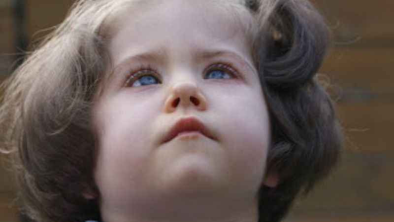 Prader Willi sendromu nedir