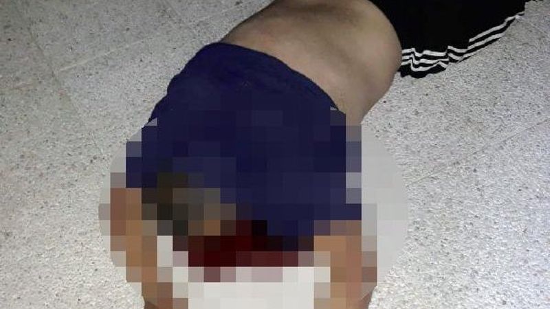 Zillere basıp yardım istedi, kapı önünde öldü