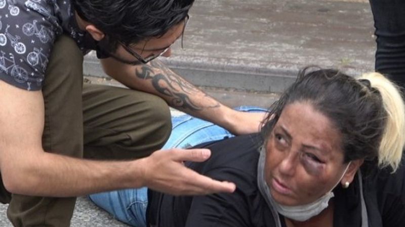 Denizli'de köpekten korkan kadın motosikletten düştü