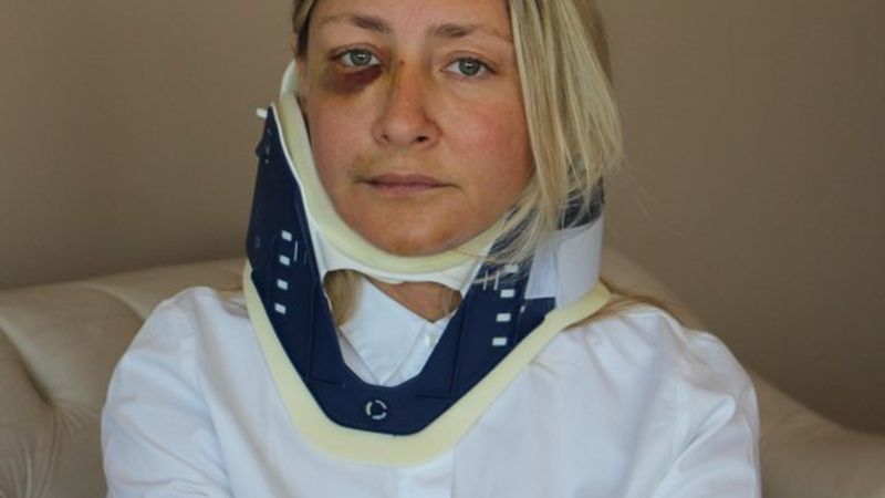 Kuşadası'nda saldırıya uğrayan banka müdürü konuştu