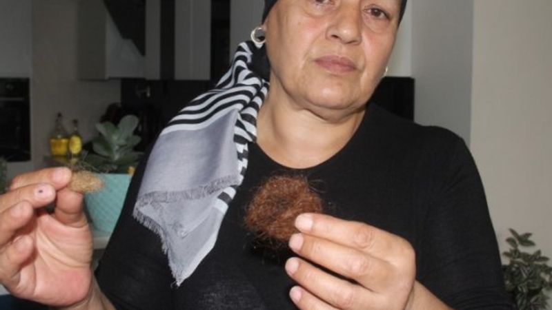 Kızının saçlarını gösterdi: Sürekli dayak yiyordu