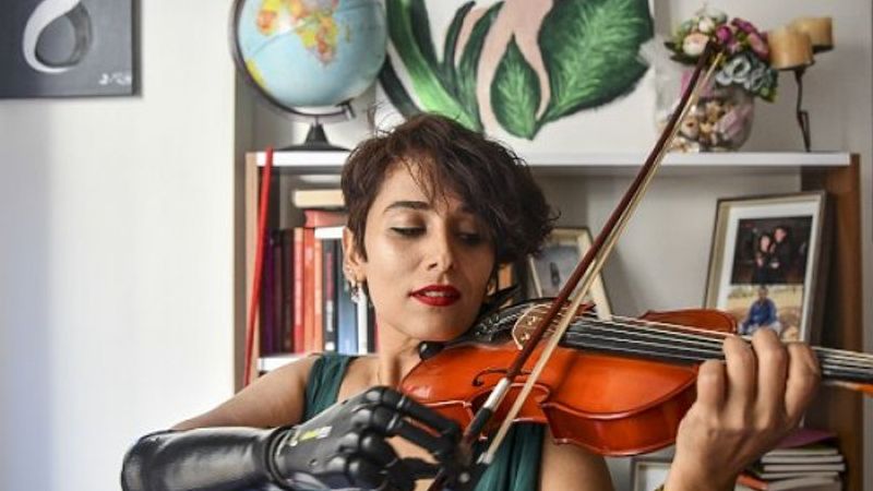 Gaziantepli Zübeyde, biyonik koluyla hayata tutundu